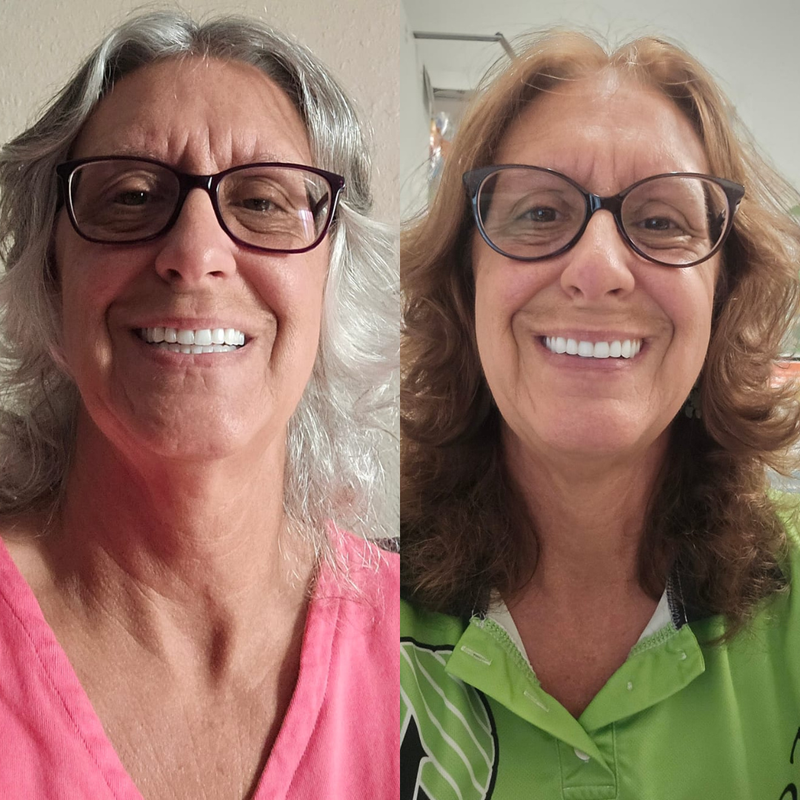 Benefits illustration